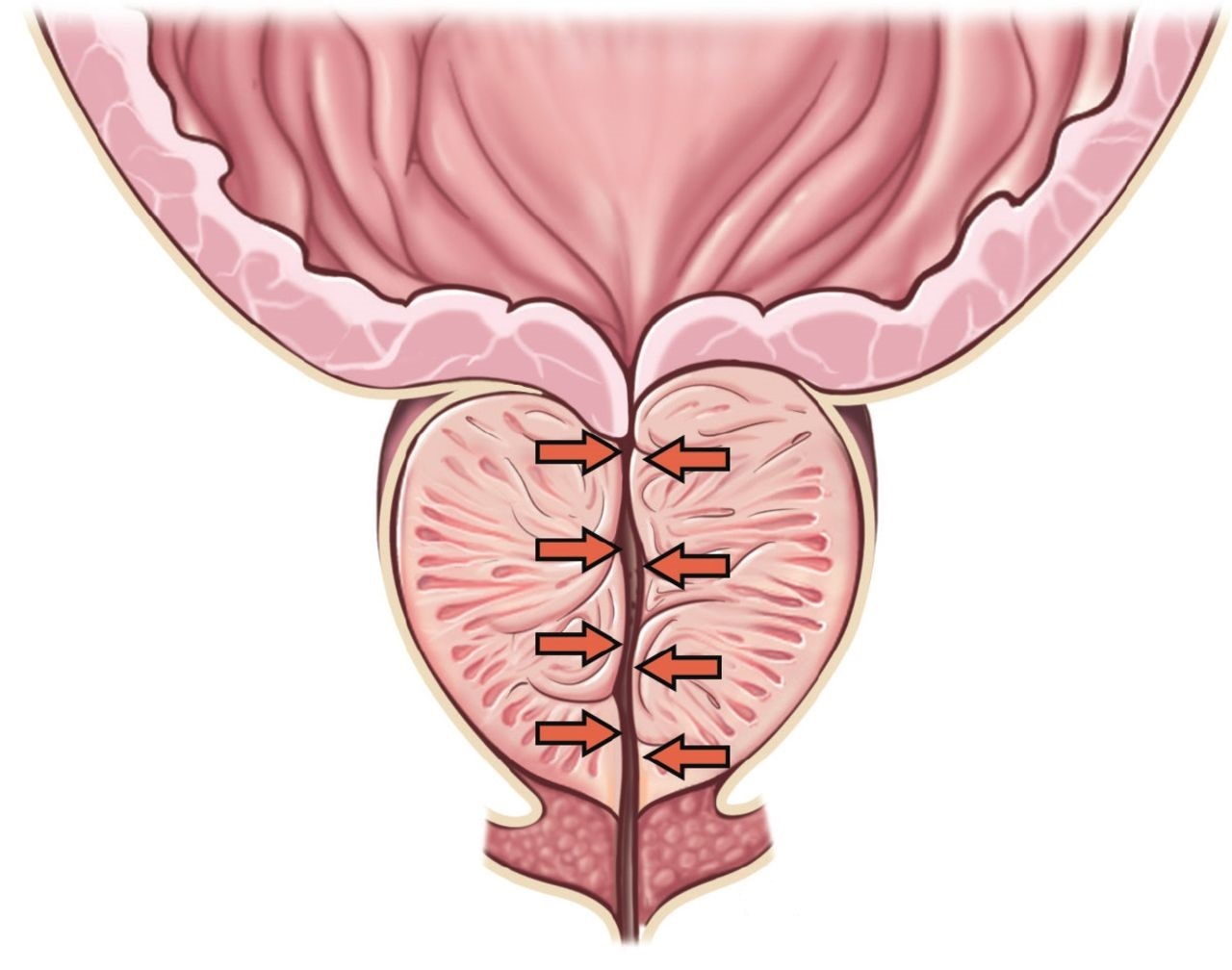 6 trieu chung u xo tuyen tien liet o nam gioi can di kham 670cf97ea8844