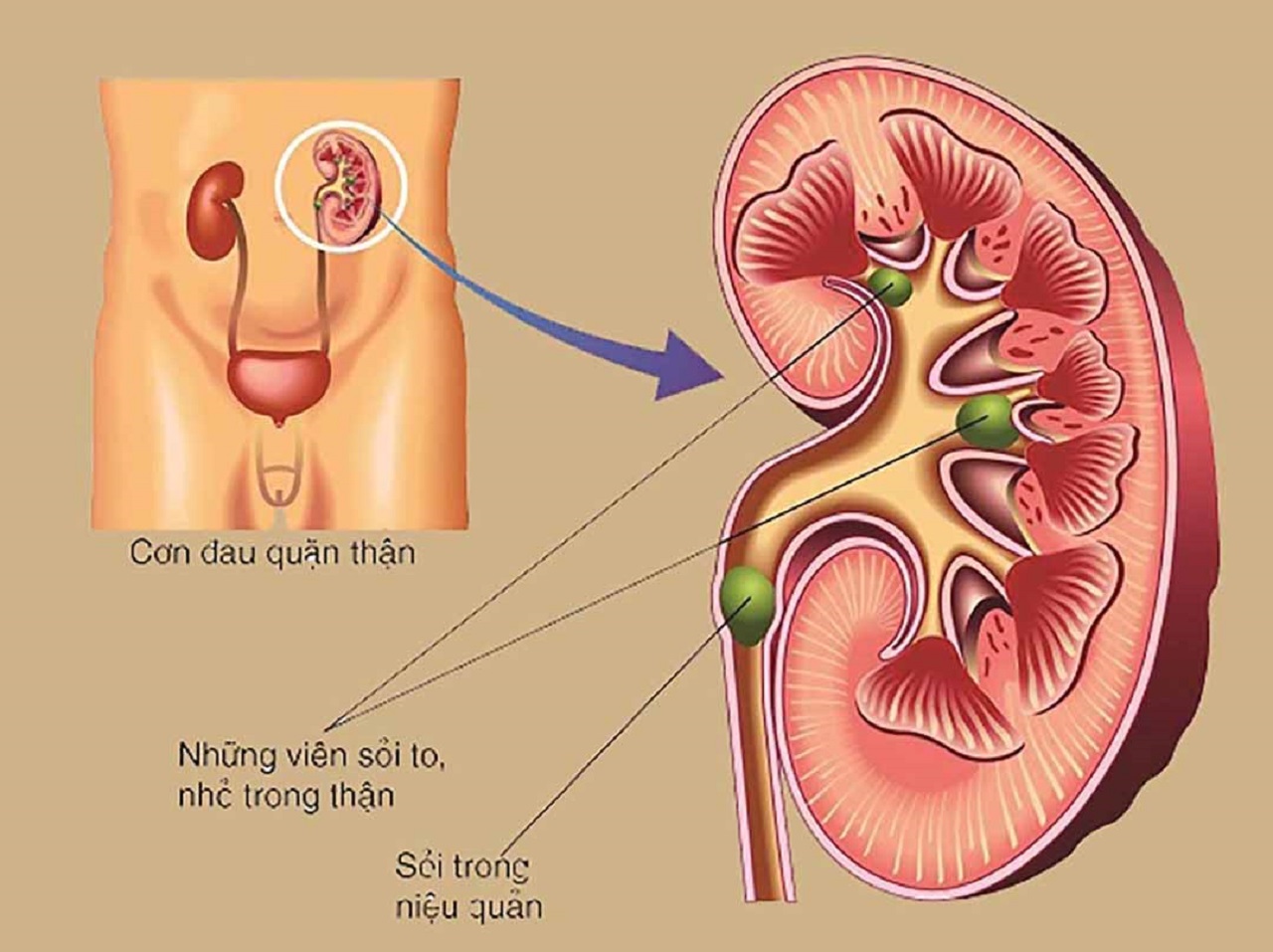 bieu hien cua soi than va cach xu tri hieu qua 670cf9190e643