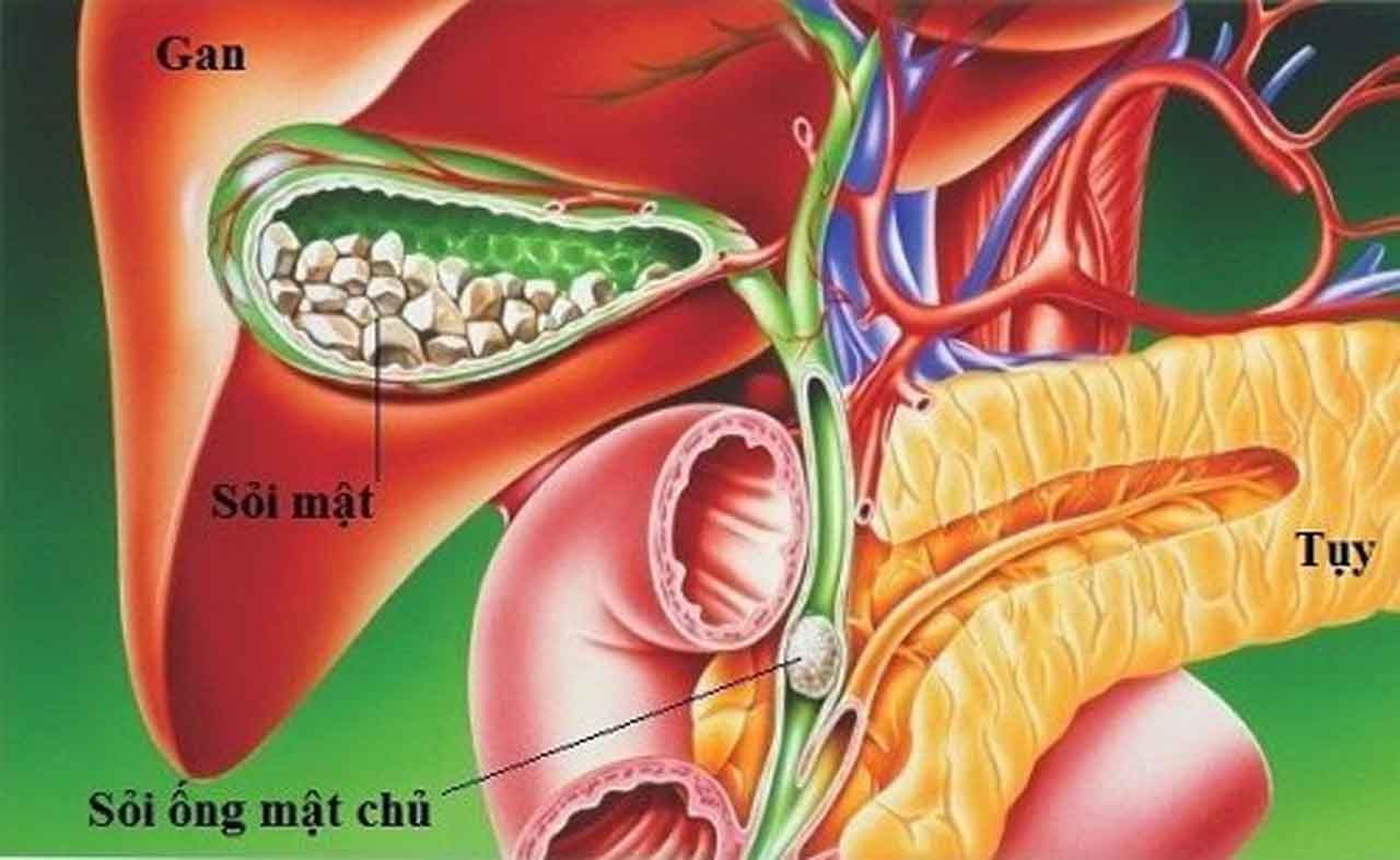 cach tri soi mat hieu qua ban can biet 670cf778d3f63