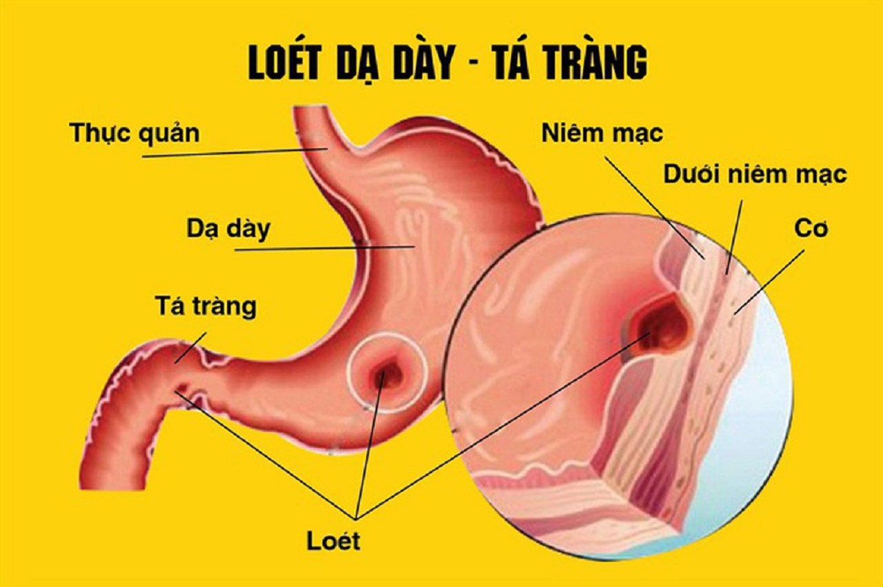 loet nong hanh ta trang bieu hien va cach chua tri 670e9741bf6de