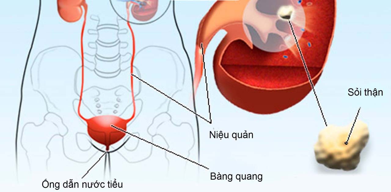 mo mo lay soi nieu quan co nen khong 670d03f696df7