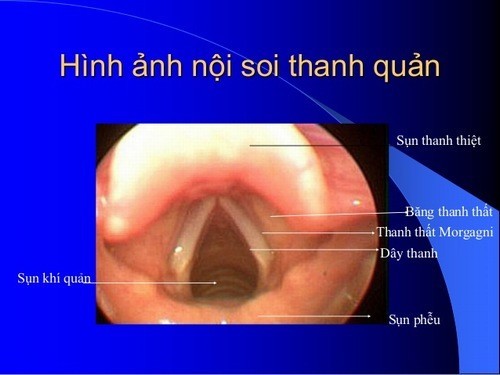 noi soi thanh quan co dau khong 670d07f89d7a3