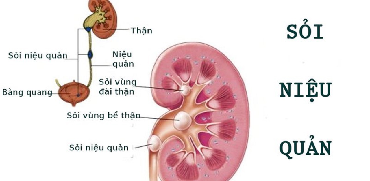 soi nieu quan va noi soi sau phuc mac lay soi nieu quan 670cf5973db01