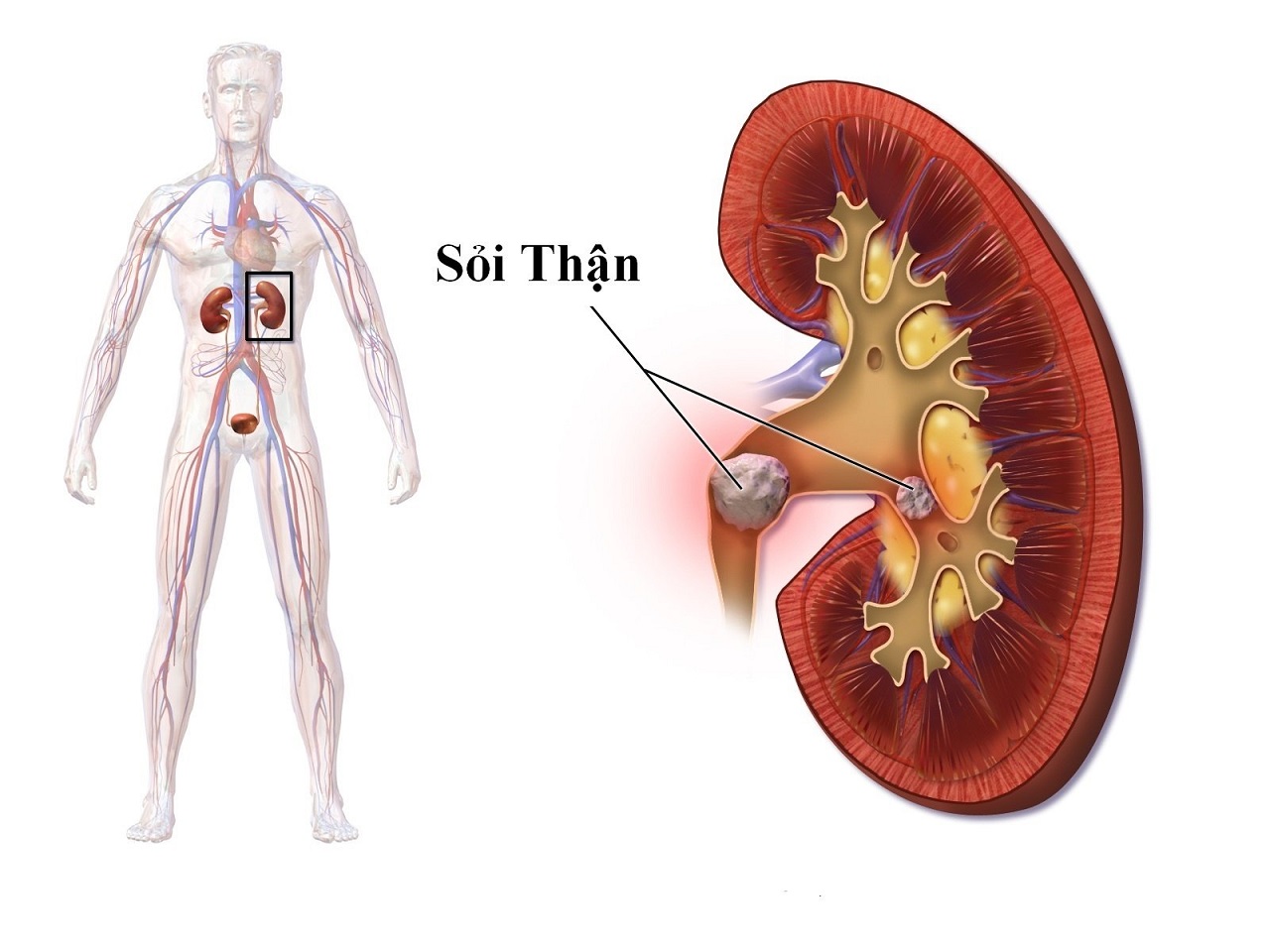 soi than 4mm co nguy hiem khong 670cf8570c1bb