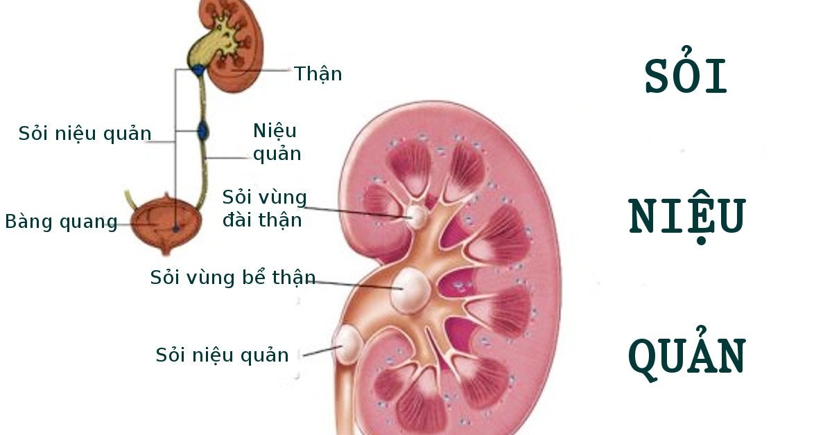 soi than xuong nieu quan nhung nguy hiem kho luong 670cfdbf69074