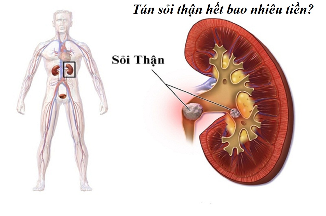 tan soi than het bao nhieu tien va cac phuong phap tan soi than 670cfa6d898a5