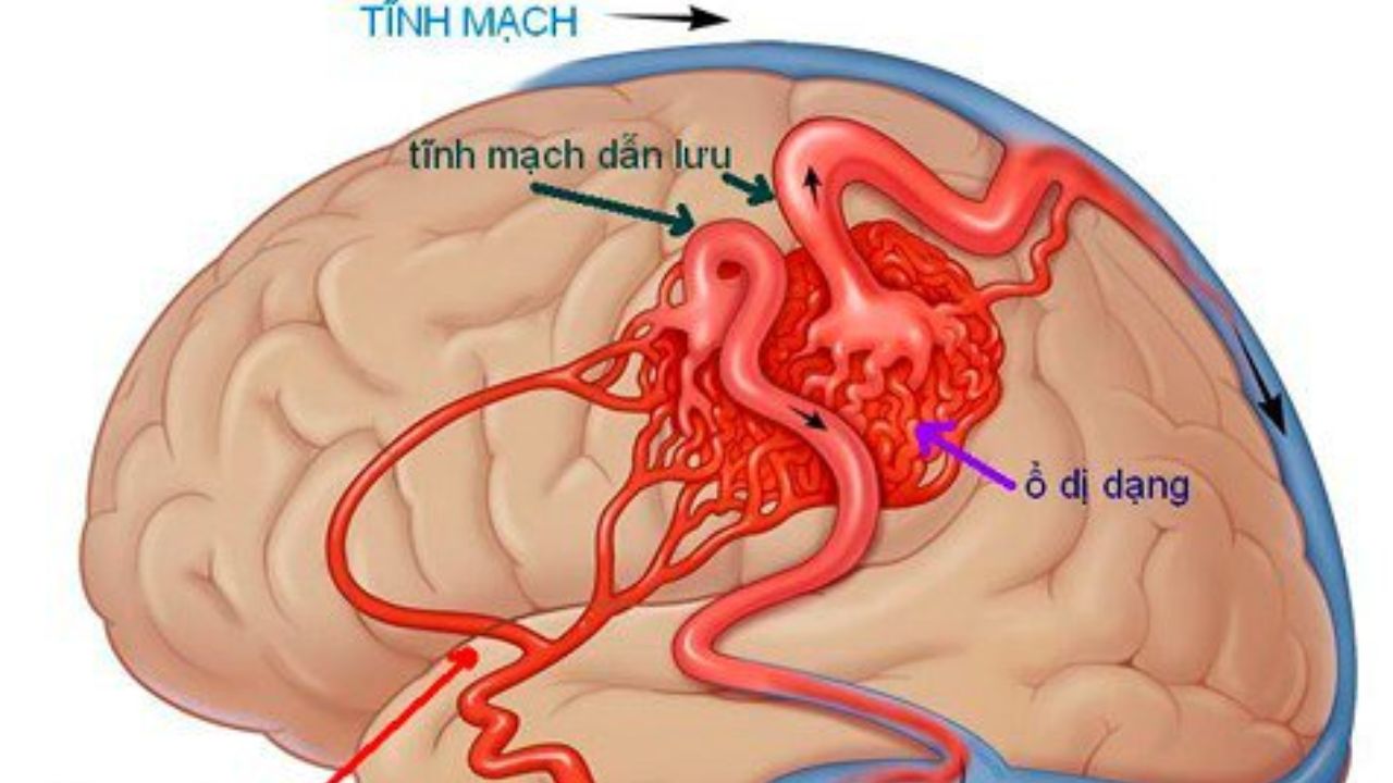 tim hieu nguyen nhan va dau hieu di dang mach nao 670d19c19c067