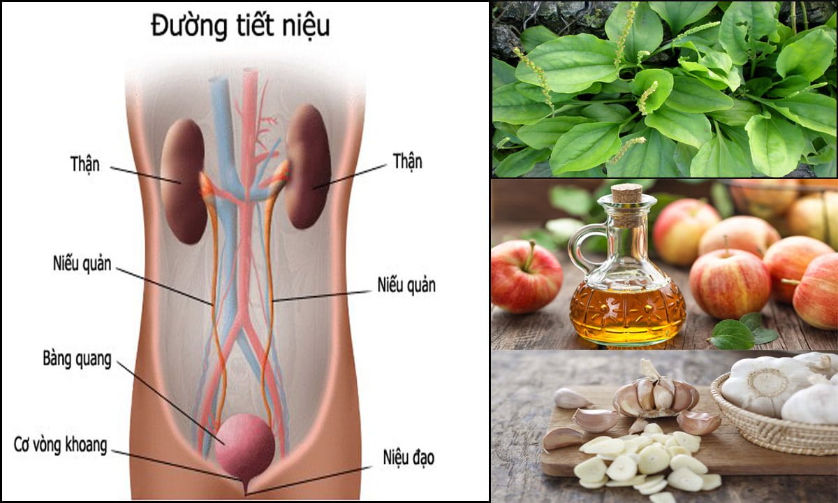 viem tiet nieu uong nuoc gi de ho tro dieu tri benh 670cfcf5bdb28